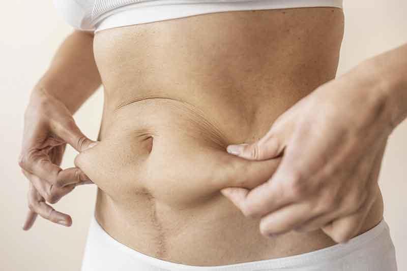 Abdominoplastie en Tunisie — ventre plat et peau raffermie