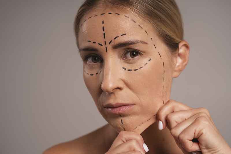 Lifting cervico-facial en Tunisie — rajeunissement du visage et du cou
